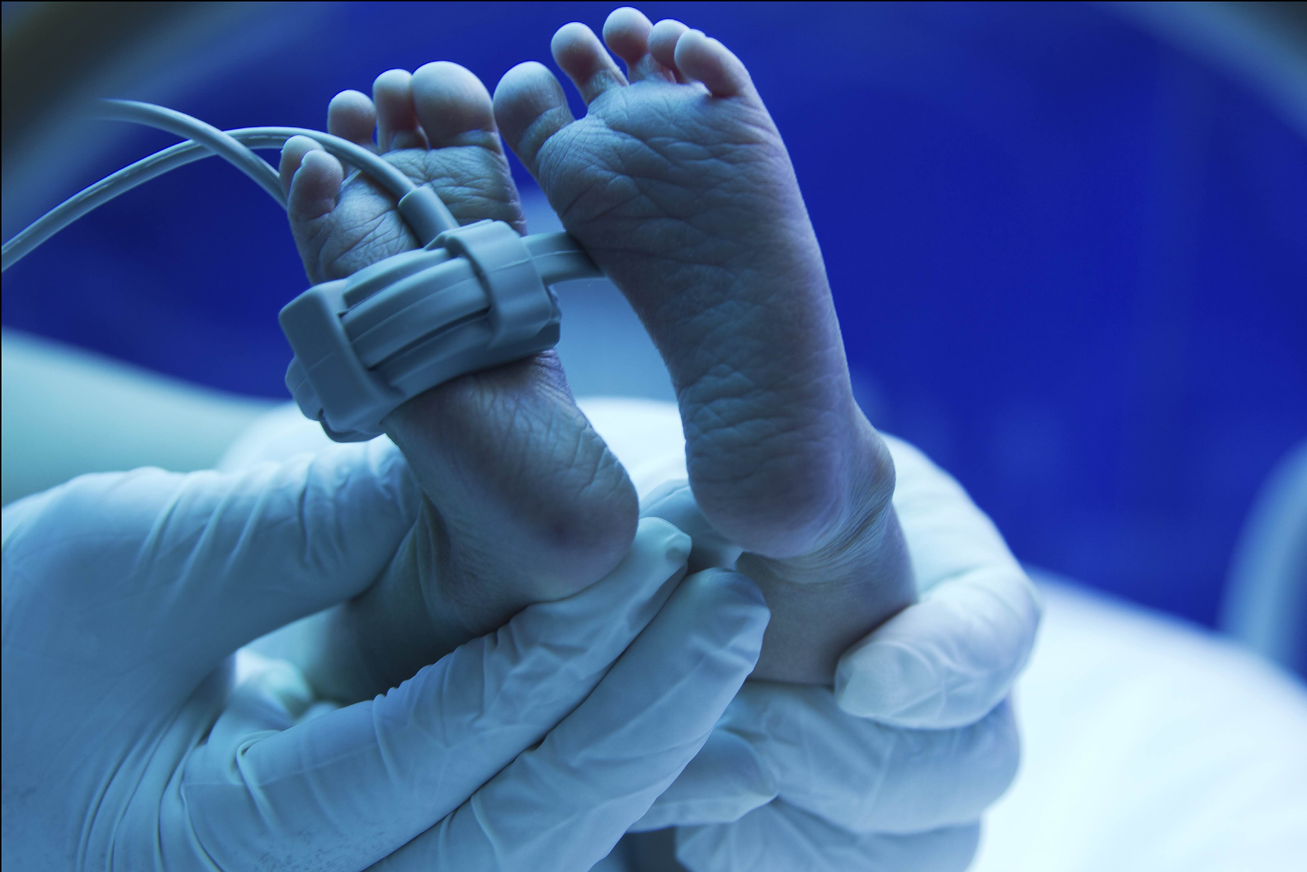 Réanimation néonatale en salle de naissance